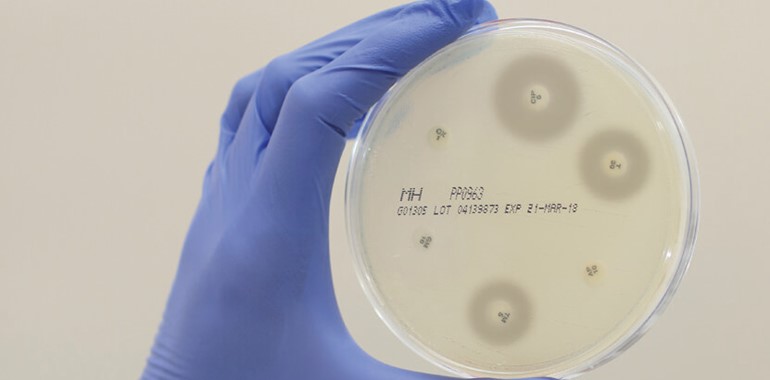Advanced Microbiology Solutions | AstraMed