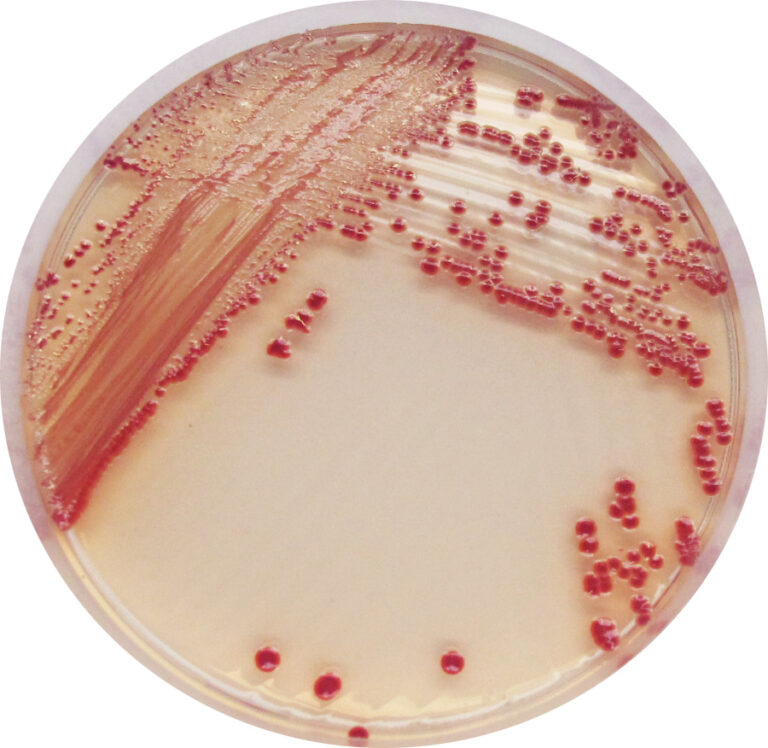 CHROMagar Acinetobacter, 20 plates