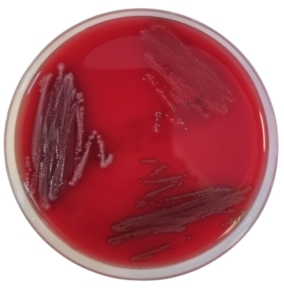 Columbia-Agar with 5 % sheep blood, 20 plates