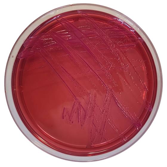 [201090] Yersinia CIN Agar, 20 paruoštų naudoti lėkštelių