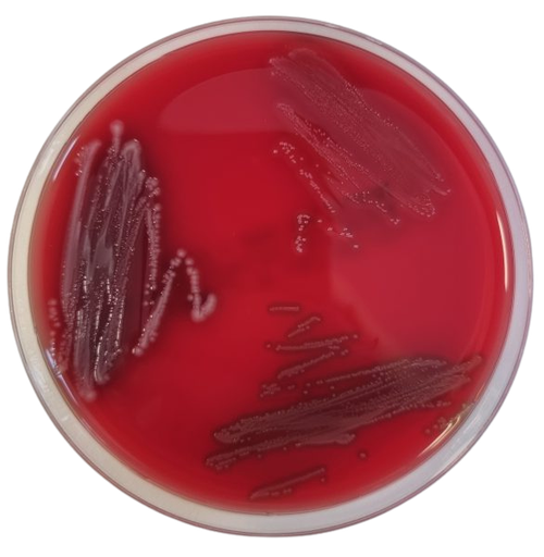 [201190] Columbia-Agar with 5 % sheep blood, 20 plates