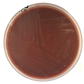 [201080] Chocolate Agar with Poly Vitex 20 plates
