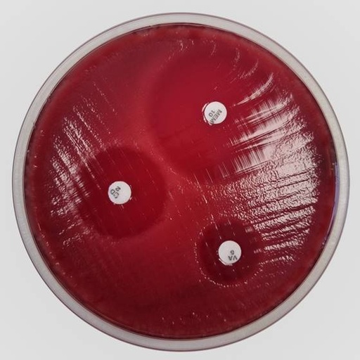 [201371] FASTIDIOUS ANAREOBE AGAR (FAA) with 5 % horse blood 20 plates
